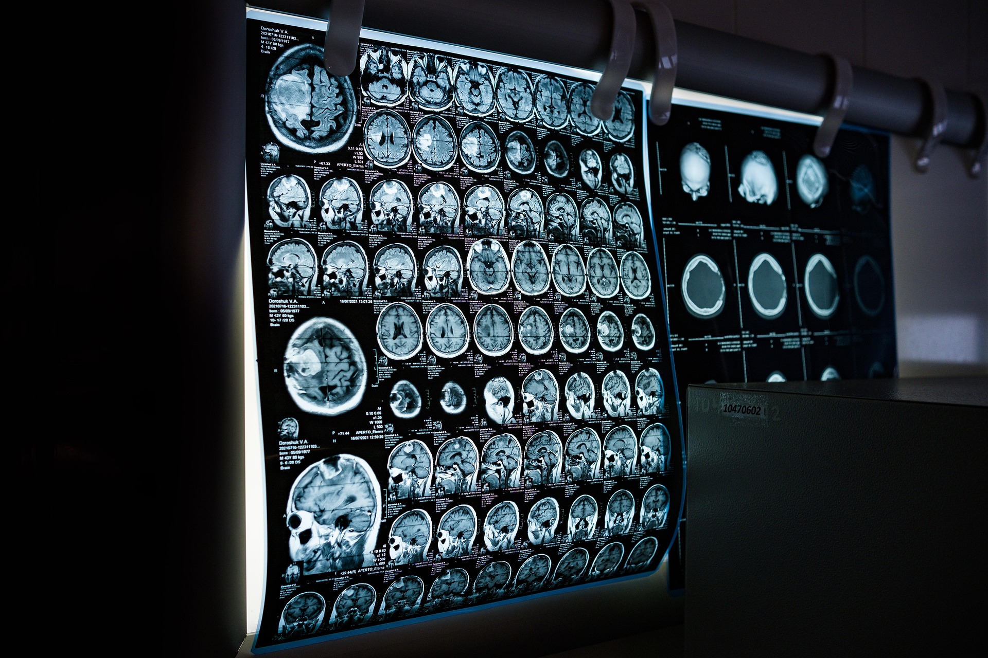 Skierowanie na MRI - zwolnienienacito.pl
